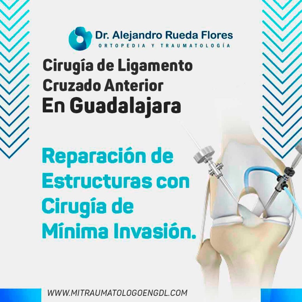 Cirugía de Ligamento Cruzado Anterior en Guadalajara