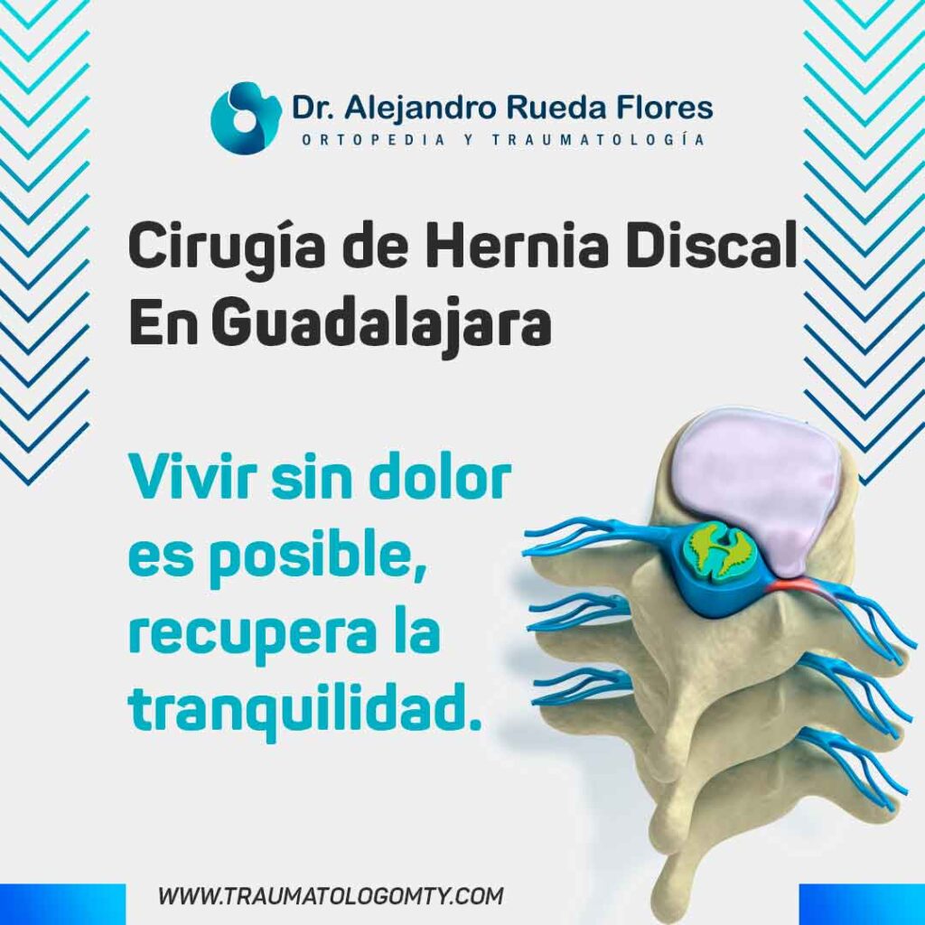 Cirugia de hernia de disco columna gdl guadalajara ortopedista