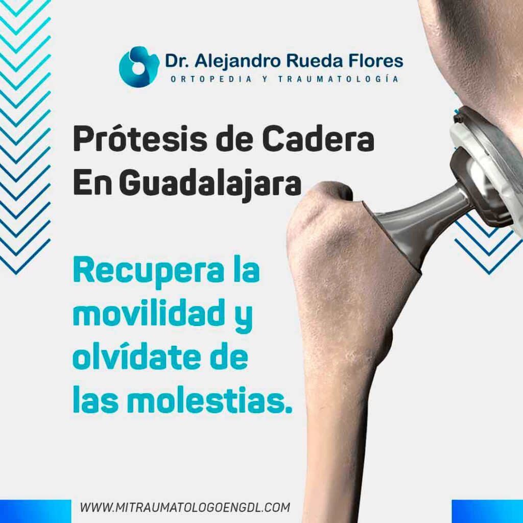 Prótesis de Cadera en Guadalajara y Zapopan