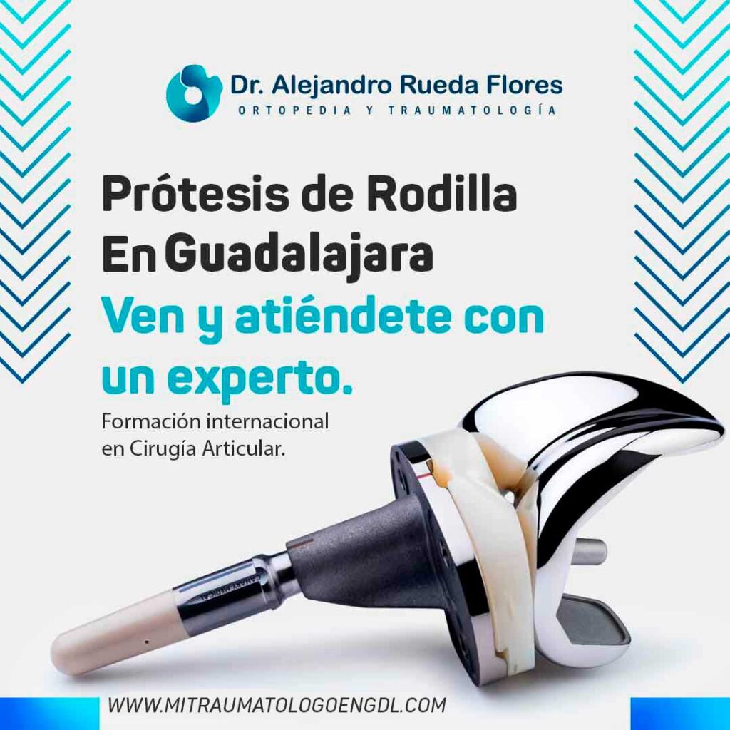 Prótesis de Rodilla en Guadalajara y Zapopan